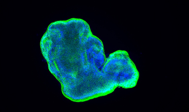 blue- and green-stained cells form a lumpy-looking 3D structure