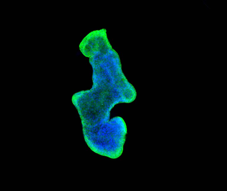 blue cells in a irregular blob with glowing green around the edges