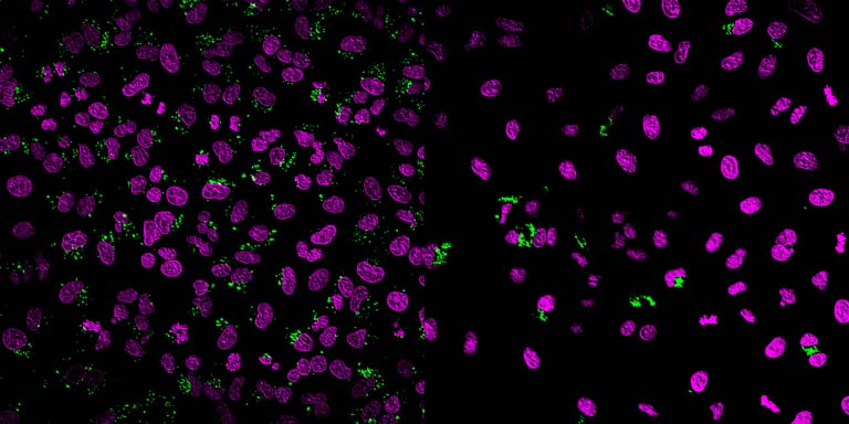 two panels of purple cells with green dots, zoomed out view on the left