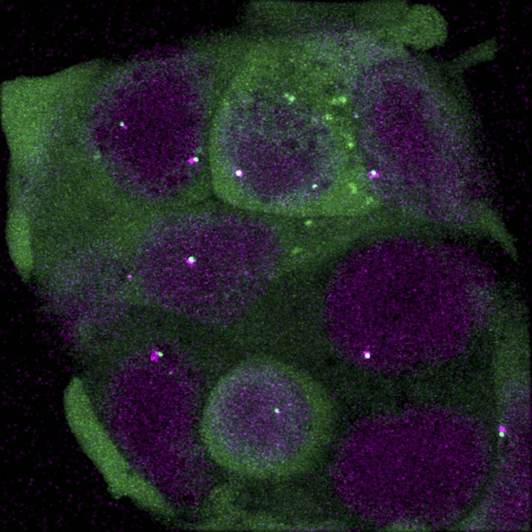 fuzzy purple cell structures with fuzzy green material surrounding and glowing spots within them