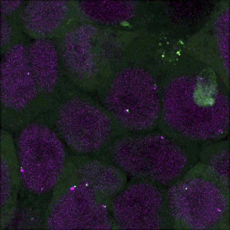 fuzzy purple cell structures with fuzzy green material surrounding and glowing spots within them