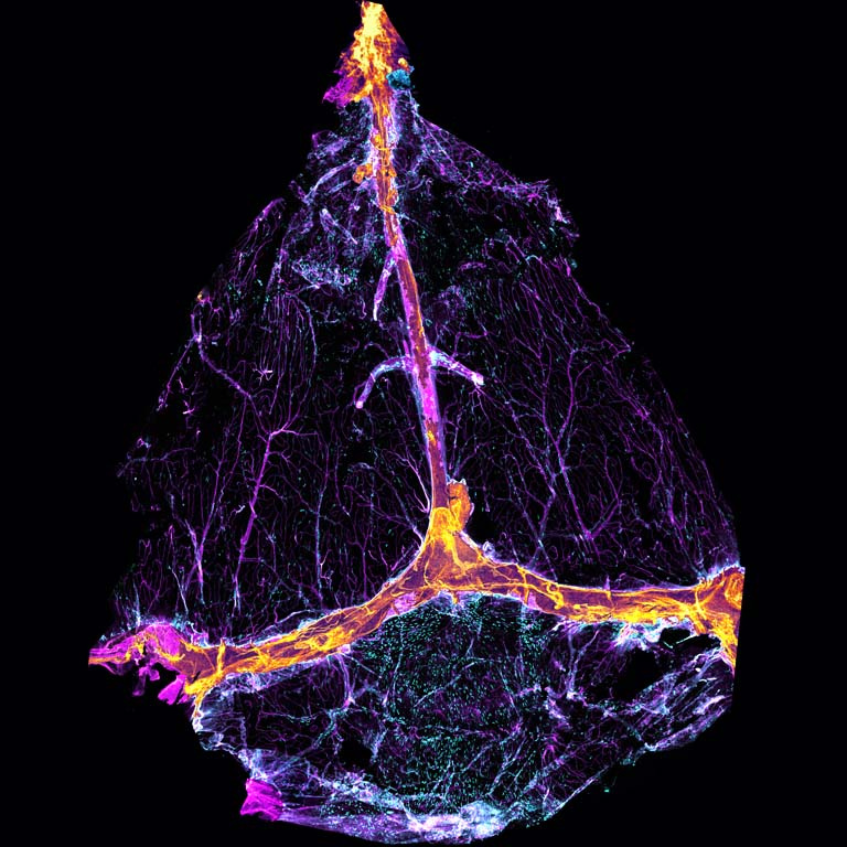 branching cellular structures in pink, orange, and blue