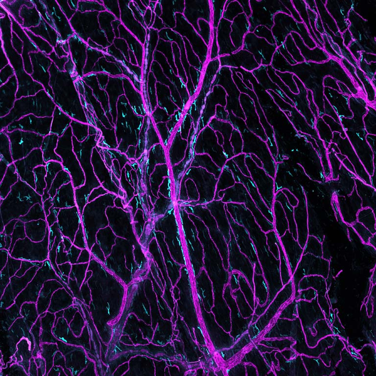 long branching cellular structures in magenta and cyan