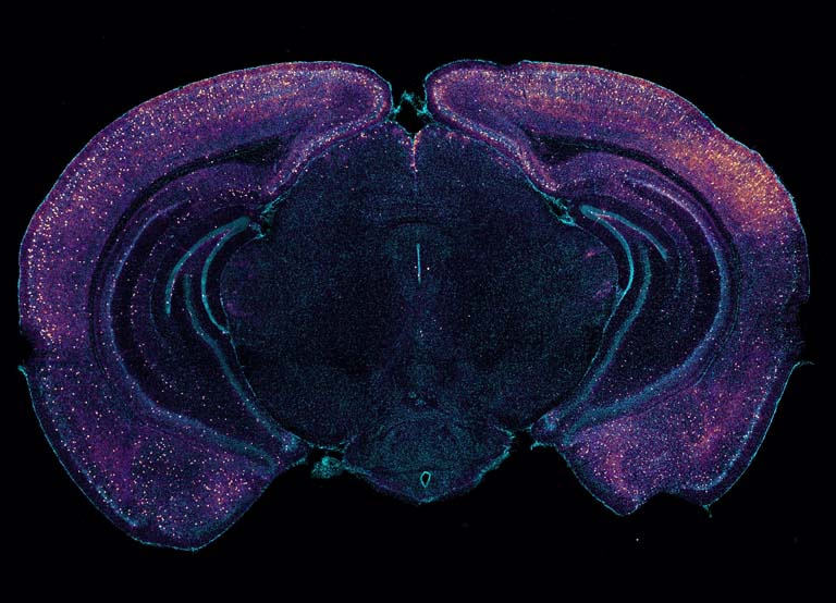 a central mass of brain tissue with arc-like tissue structures around it