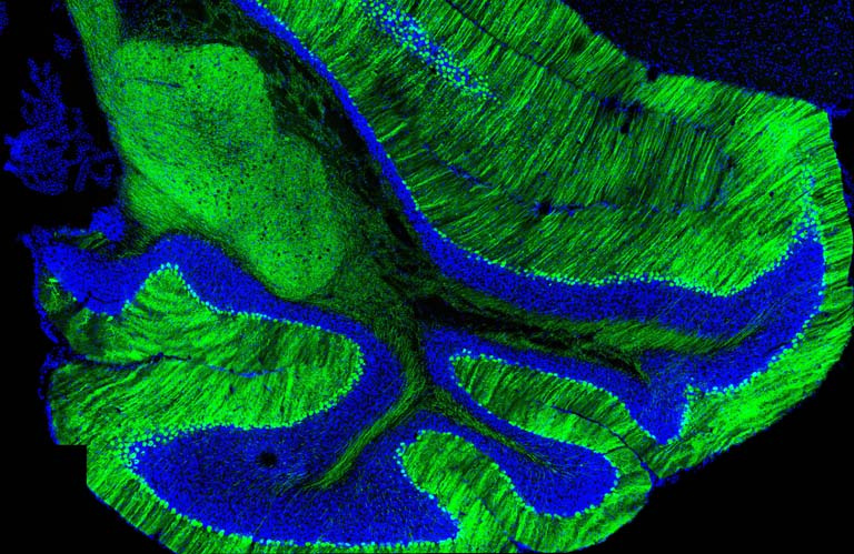folds of brain tissue in striated blue and green