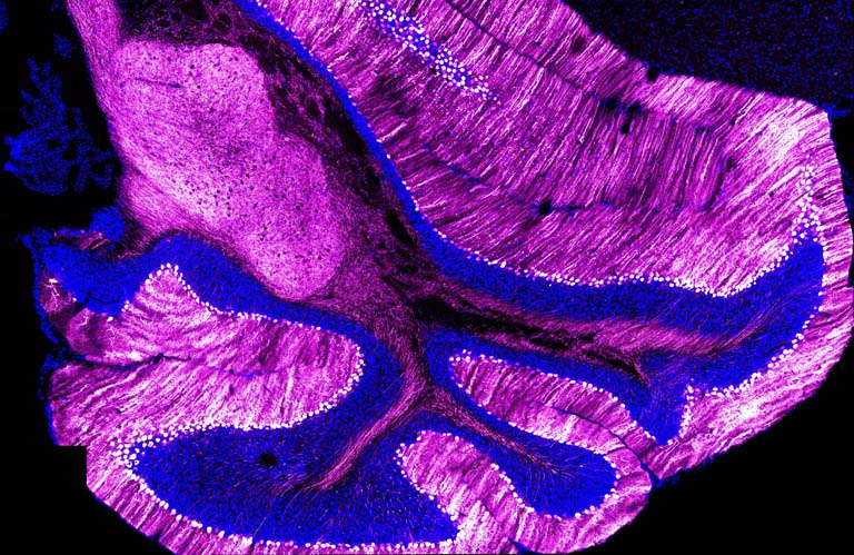 folds of brain tissue in striated blue and magenta