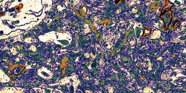 A field of round cells spreads across a horizontal field. Blue and purple cells are punctuated with green and orange cells, with cream-colored patches on the left.