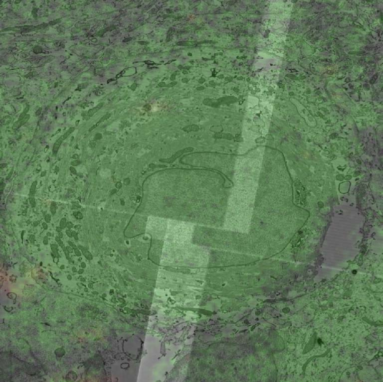a circular green haze of dark spots and rings is overlaid by pale thick green lines splitting the field into four uneven quadrants