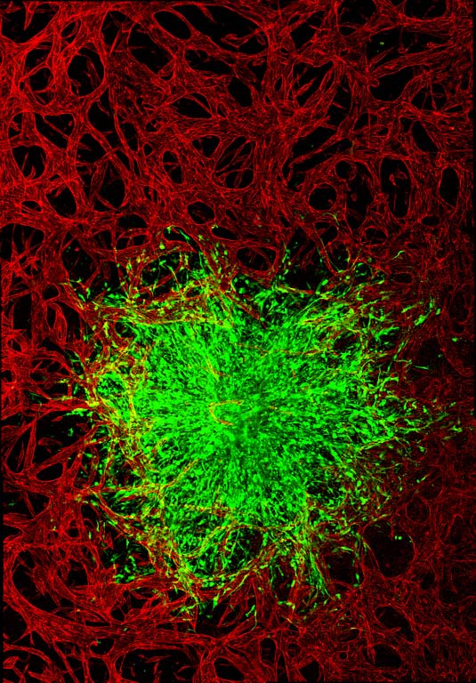 a network of red-colored cells surrounds a flowery cluster of green-colored cells