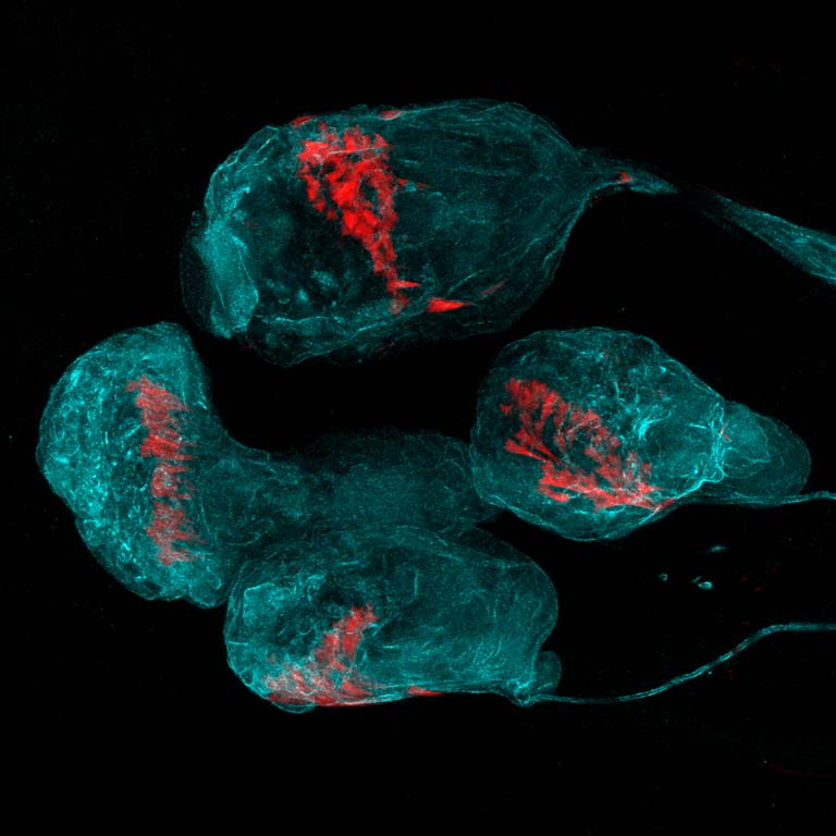 translucent balloon-like structures colored cyan enclose glowing red proteins in elongated clusters