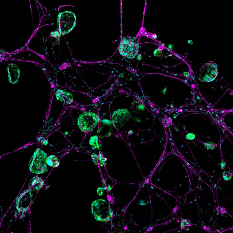 tendrils of magenta-colored cells lace between bubbles of green-colored cells
