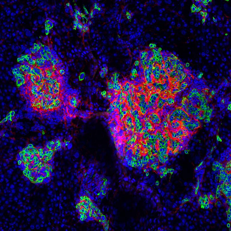 stylized clusters of various sizes contain interspersed cells in red, blue, and green