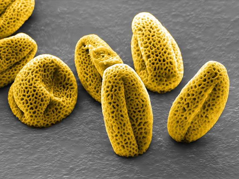 irregularly oblong porous grains of pollen colored yellow stick up from a grey surface