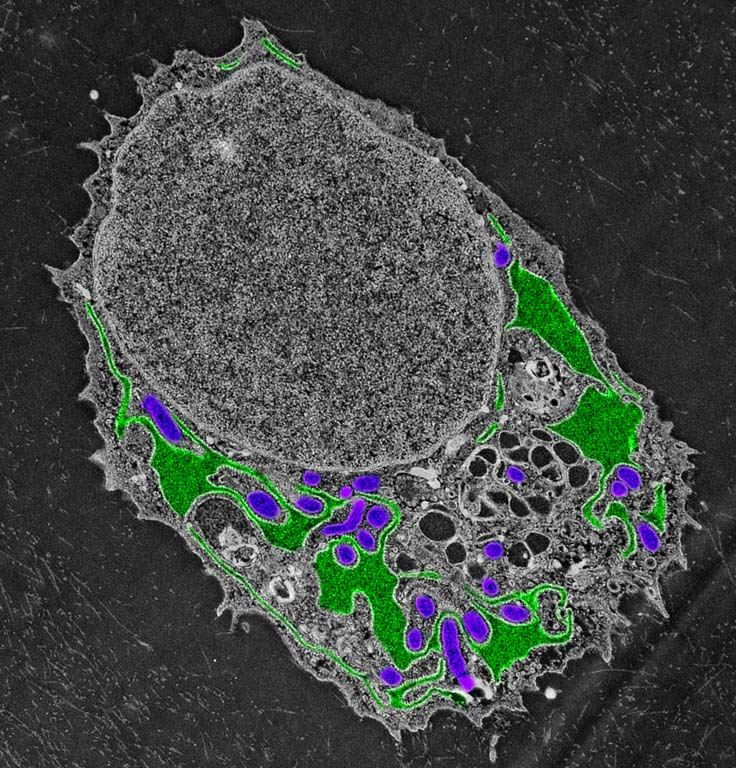 close-up view of a cell in shades of grey, containing a large nucleus with various organelles to the lower right, some of which are colored green and purple