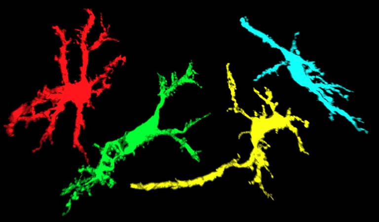 four branching neurons side by side in red, green, yellow, and cyan