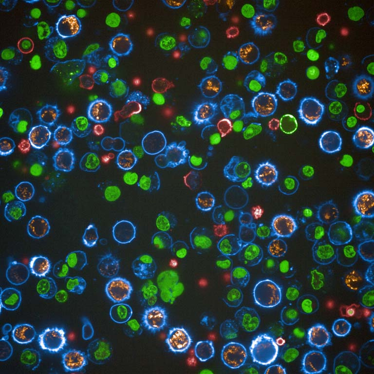 small bubble-like cells in viivid blues and greens, dotted with red and orange, fill the field of view