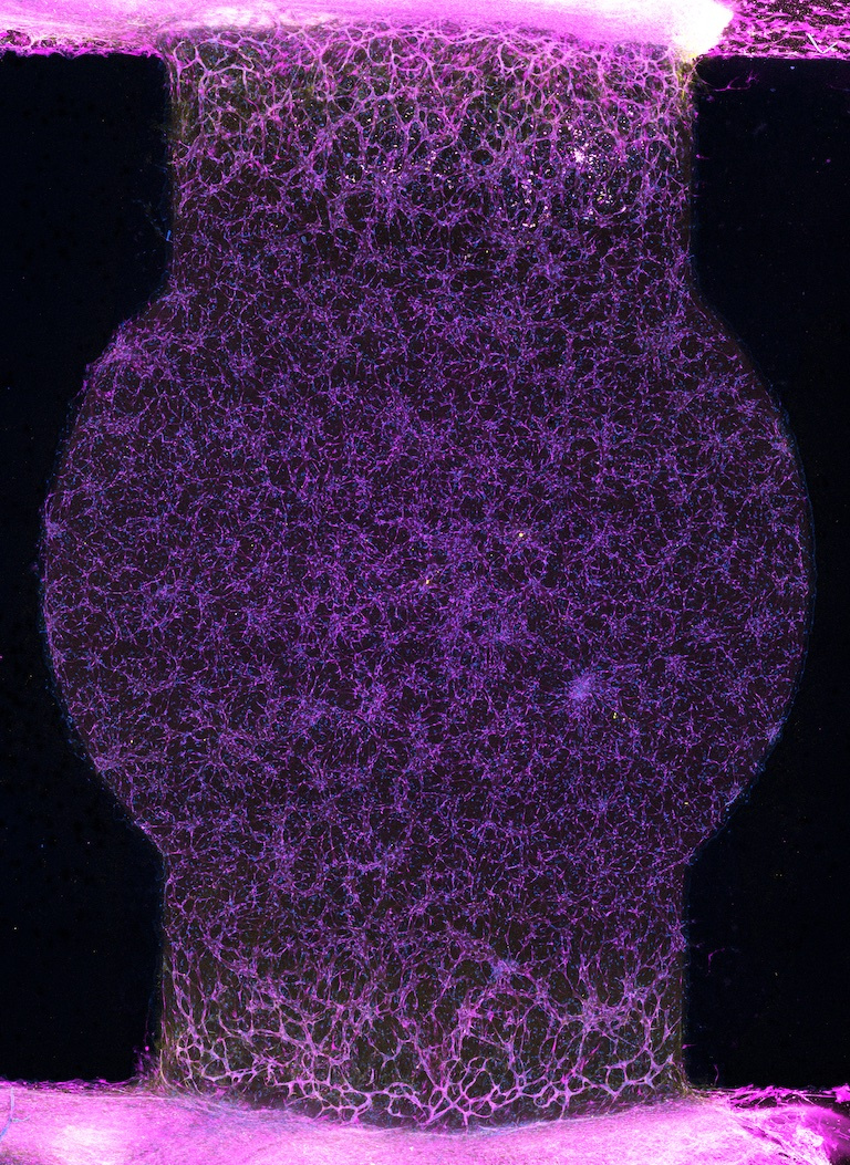 a column of purple mesh like cells, bulging in the middle and tapering at the top