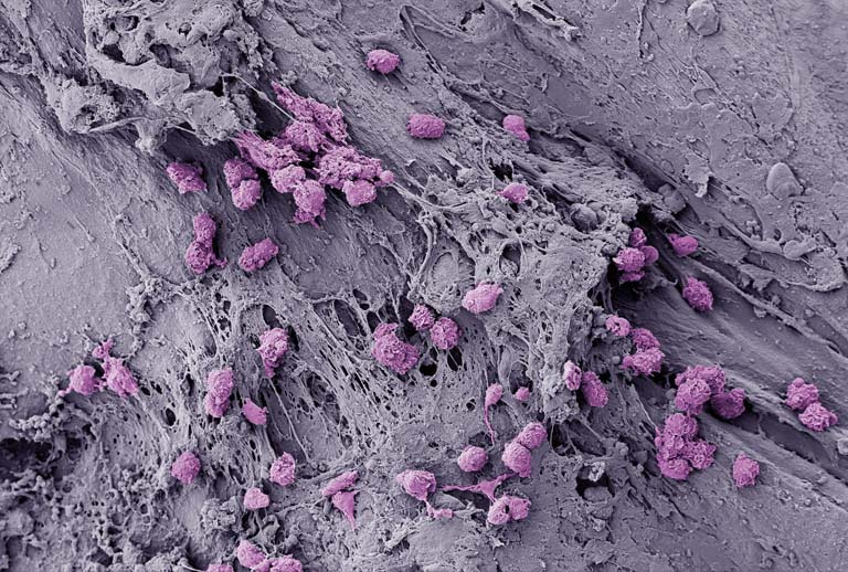 a gray clay-like field with clusters of round purple cells scattered throughout
