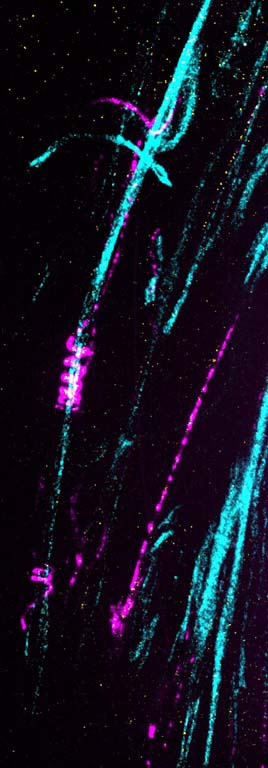 a curling protein (in magenta) spirals around a long thin bundle of axons (in cyan)