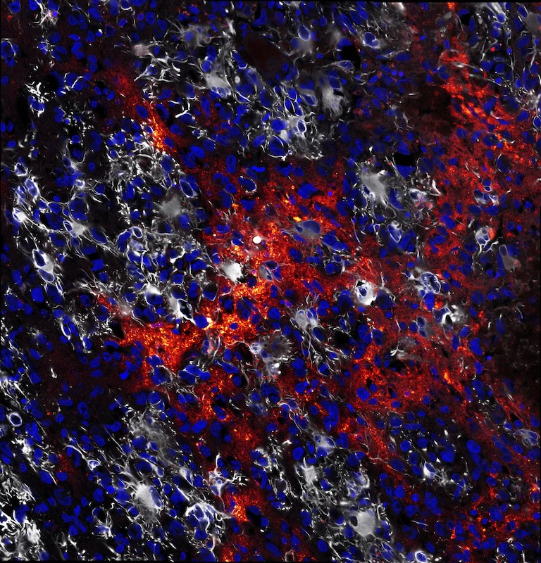 Clusters of blue, red, gray and white fibrous structures in a black background