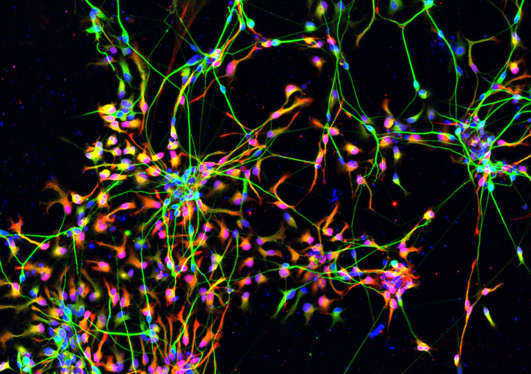 Colorful and bright complex neurons in a black background 2
