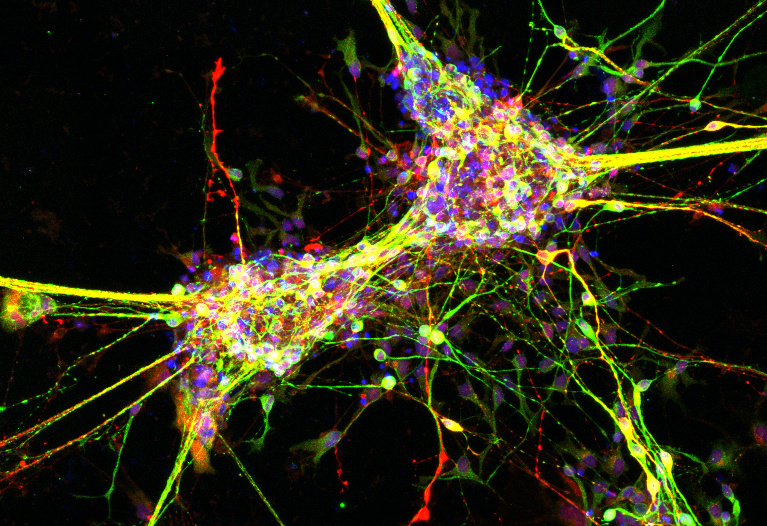 Colorful and bright complex neurons in a black background 3