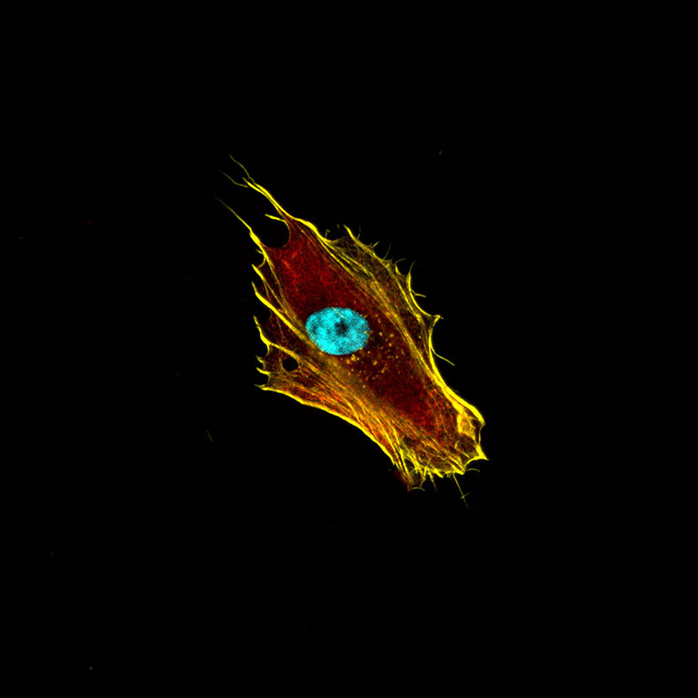 A golden cell shaped like a dragon's head on a black background. The cyan nucleus looks like an eye. Tendrils trail off the back of the so-called head.