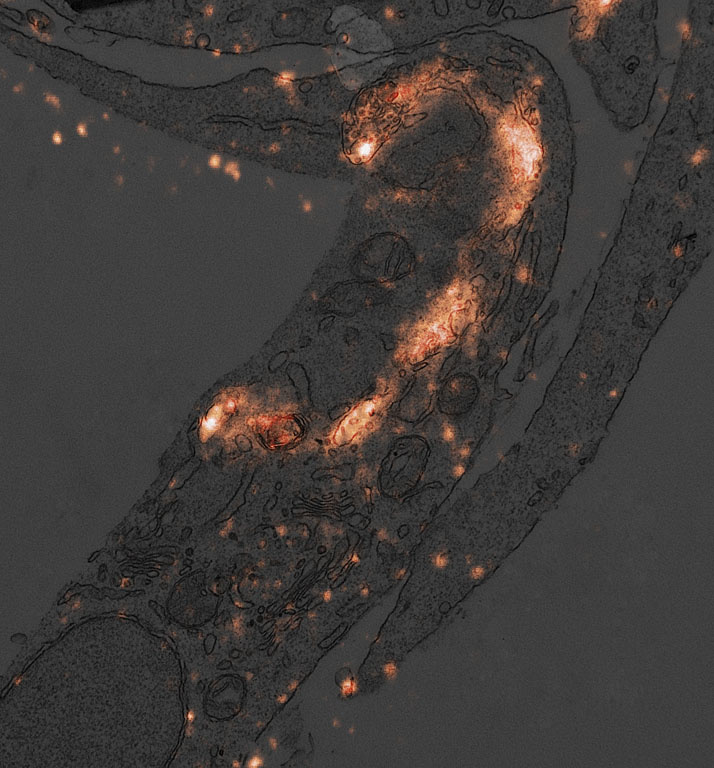  This electron microscopy image shows a section of a cell in which lysosomes were labeled with fluorescent antibodies using a specialized technique developed in our lab.