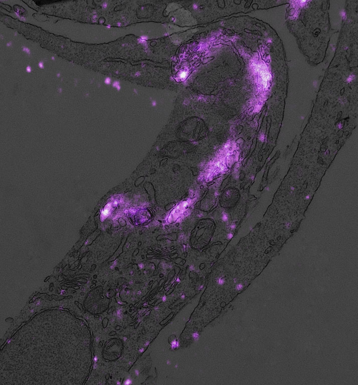  This electron microscopy image shows a section of a cell in which lysosomes were labeled with fluorescent antibodies using a specialized technique developed in our lab.