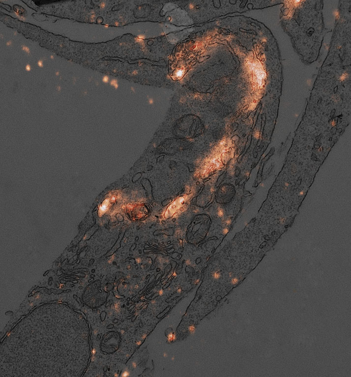  This electron microscopy image shows a section of a cell in which lysosomes were labeled with fluorescent antibodies using a specialized technique developed in our lab.
