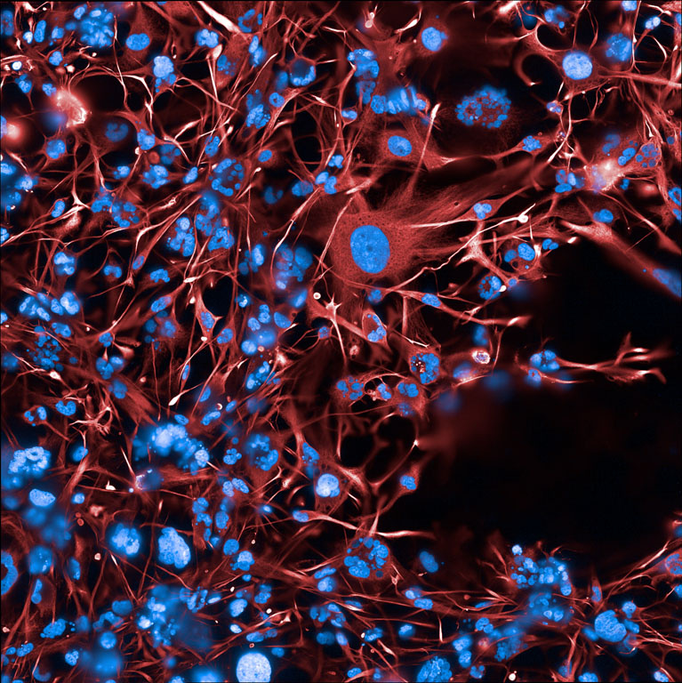Fluorescence microscopy image showing a dense network of red, thread-like cell structures surrounding numerous bright blue cell nuclei.