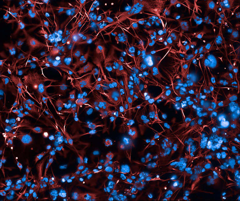 Fluorescence microscopy image showing a dense network of red, thread-like cell structures surrounding numerous bright blue cell nuclei.