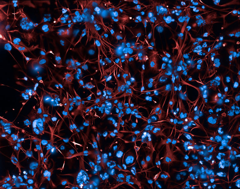 Fluorescence microscopy image showing a dense network of red, thread-like cell structures surrounding numerous bright blue cell nuclei.