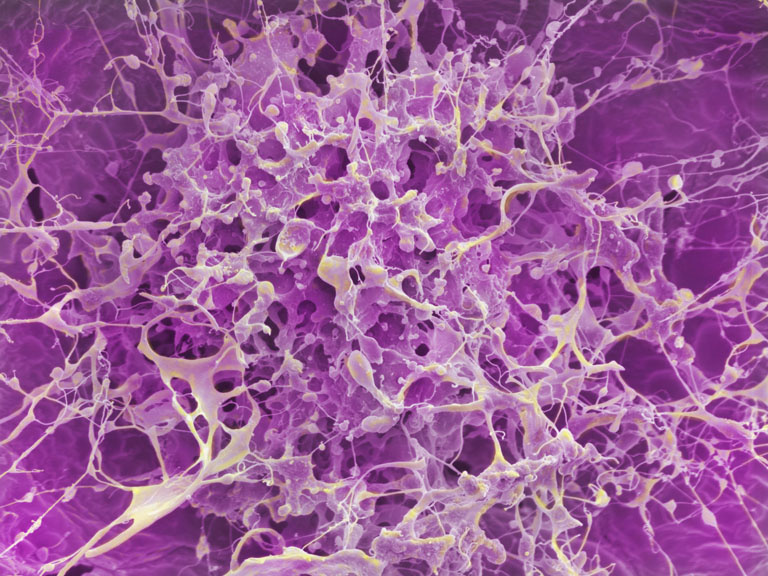 A close-up microscopic image showing a dense, web-like network of thin, branching filaments in pale yellow stretching across a vivid purple background, forming an intricate, sponge-like cellular structure with many interconnected pores.