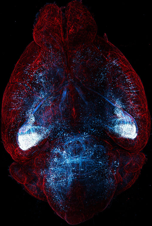 A brain illuminated with red and blue lights, showcasing a vibrant and dynamic visual representation of neural activity.