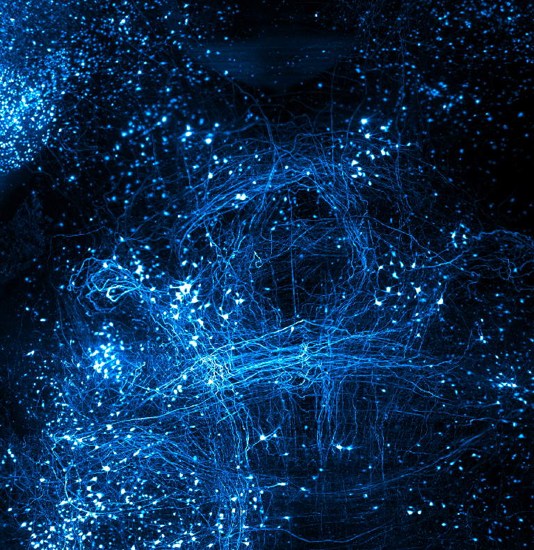 Vibrant blue background with lights, highlighting the detailed neuronal network of a transgenic mouse brain expressing GFP.