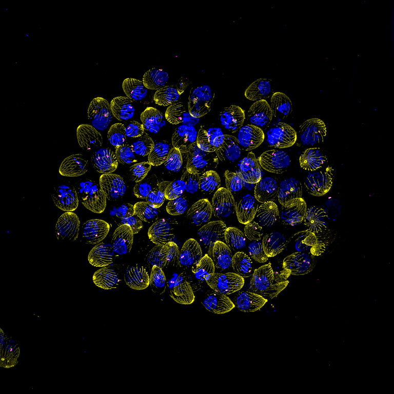 Fluorescent microscopy image of a spherical cluster of cells with blue nuclei surrounded by yellow filament-like structures on a black background.