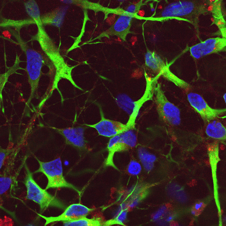 Neurons shown in green and blue light, with red vesicles from ginger, demonstrating successful binding and entry into nerve cells.