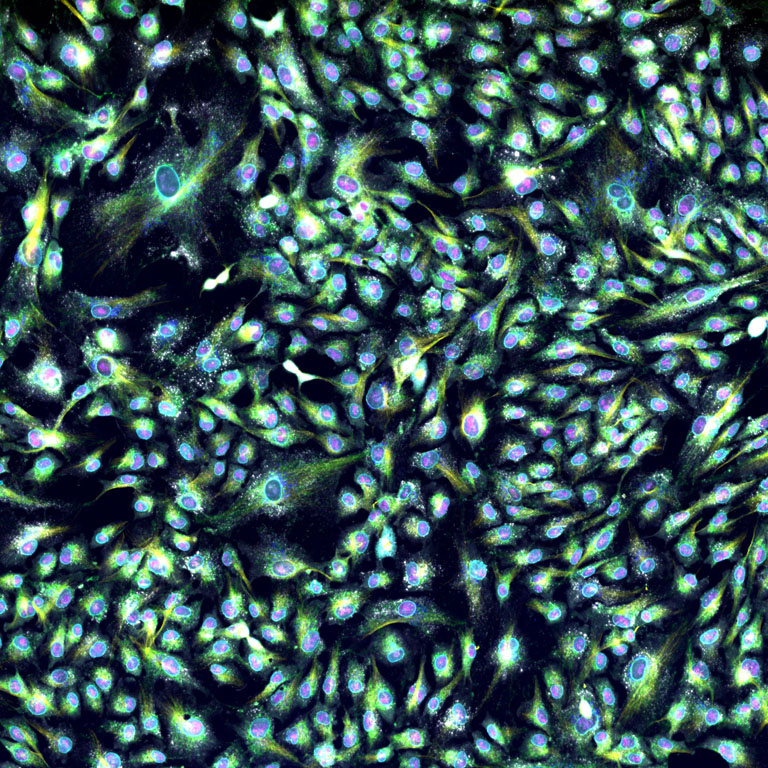Close-up of a cell displaying green and blue hues, showcasing multiplexed immunofluorescence and CRISPR genetic perturbations.