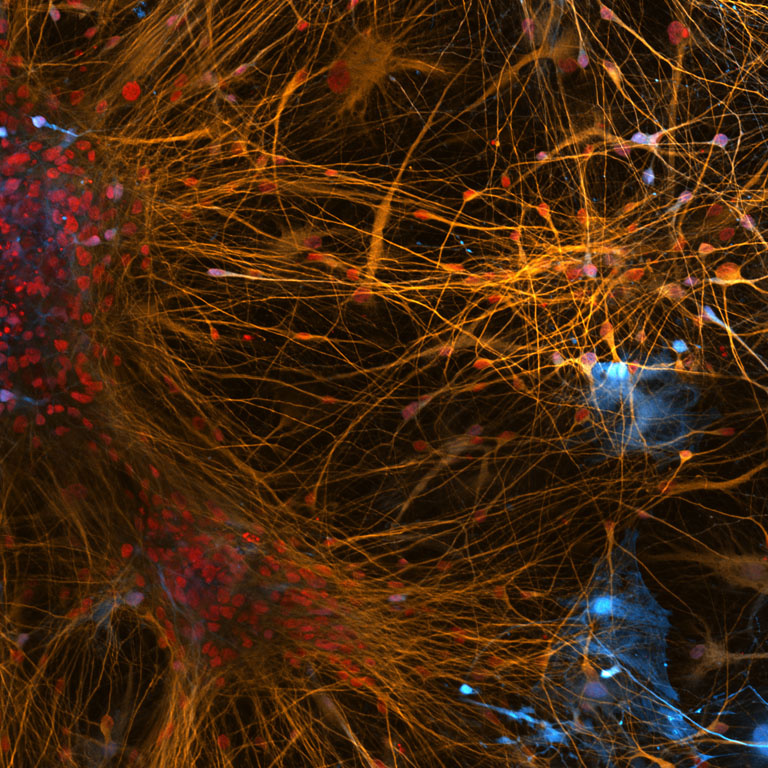 Close-up of a neuron, showcasing intricate details of a brain cell's structure and connections.