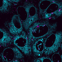 Blue nuclei with what looks like a little octopus in the center nucleus