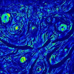 Fallopian tube tissue that is colored very similar the Van Gogh's Starry Night 