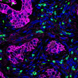 A blue highway of green cells, and magenta structures emerging throughout