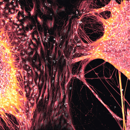 It looks like two suns that have dancing solar flares between them