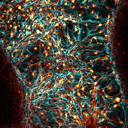 Like a hurricane of teal and lightning interacting violently and in harmony