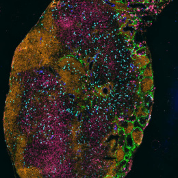 A burnt orange lymph node with blue sprinkles of blood vasculature making their way to the green edges