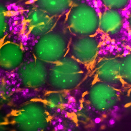 Green yolks floating in the ether of orange string and pink boba pearls