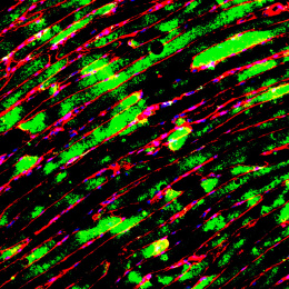 Neon Zebra stripes made of neon pink outline and bright green fill in