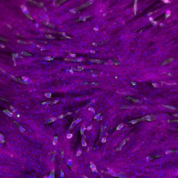 Magenta muscle strands