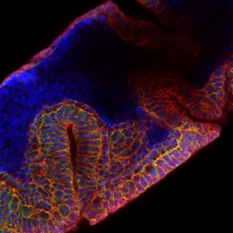 Neon purple oblong shape filled with coils of yellow shimmering wrinkles 